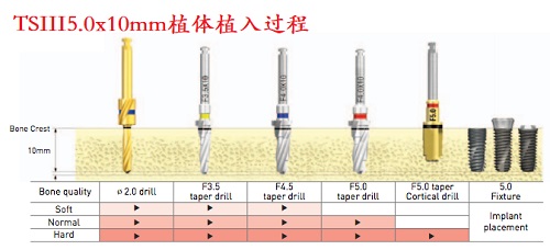 5010impt.jpg